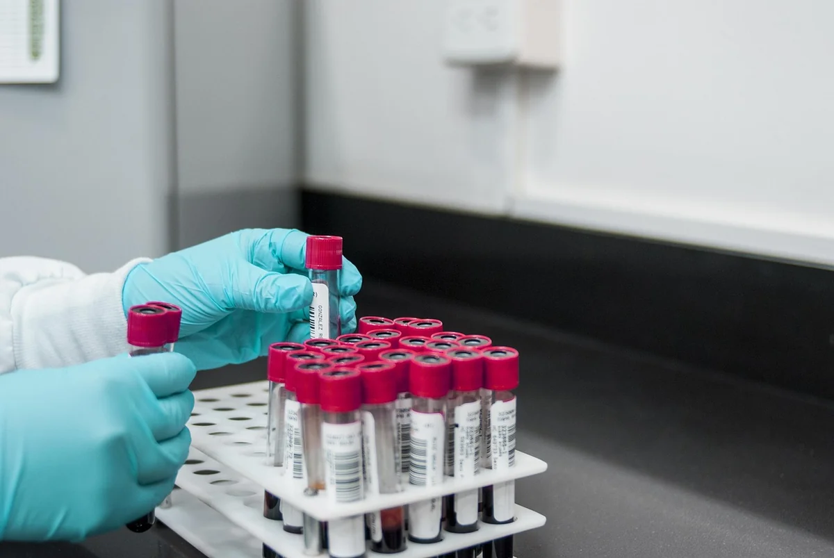 Comment structurer un AB test qui donne des résultats fiables