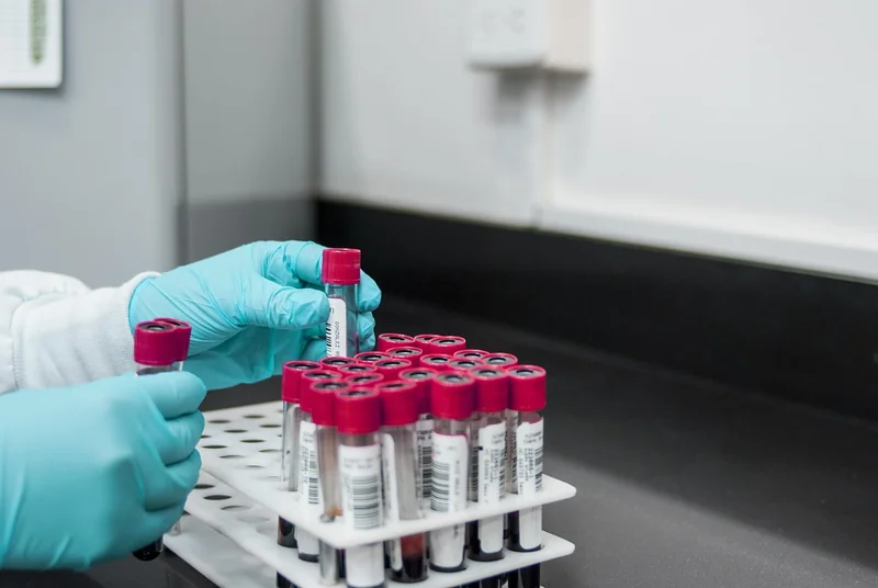 Comment structurer un AB test qui donne des résultats fiables